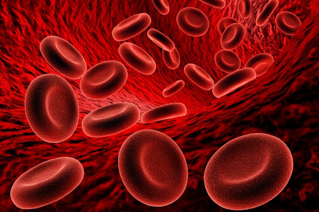 AdobeStock 205502121 Acquired aplastic anemia